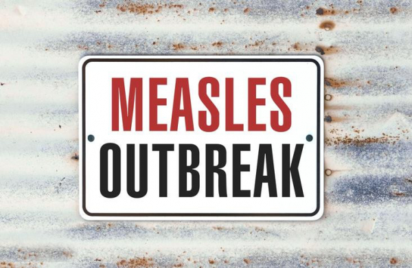 Measles is making a comeback: Can we stop it? post thumbnail image